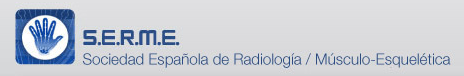 Sociedad Española de Radiología Músculo-Esquelética
